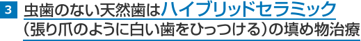 3.虫歯のない天然歯はハイブリッドセラミック（張り爪のように白い歯をひっつける）の填め物治療