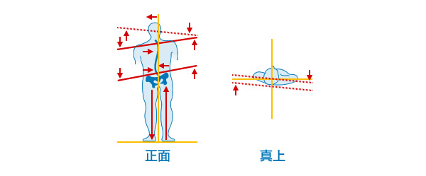 首の骨がズレると、背骨全体がS字状に歪みます。及び骨盤がズレます。そして体の不調がでてきます。